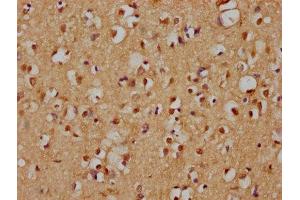 IHC image of ABIN7157954 diluted at 1:200 and staining in paraffin-embedded human brain tissue performed on a Leica BondTM system. (RANBP3L 抗体  (AA 170-295))