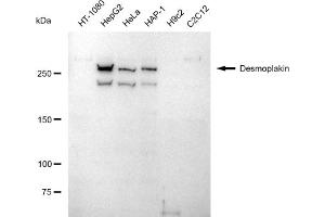 Western blotting analysis using Desmoplakin antibody (ABIN7798318).
