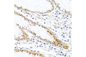 Immunohistochemistry (IHC) image for anti-Family with Sequence Similarity 3, Member B (FAM3B) (AA 30-235) antibody (ABIN3021391)