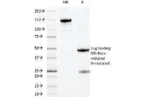 SDS-PAGE Analysis Purified MYADM Mouse Monoclonal Antibody (MYADM/971). (MYADM 抗体)