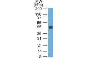 Western Blot Analysis of rat Colon lysate probed with Ep-CAM Monoclonal Antibody (SPM534).