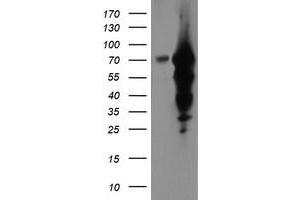 Western Blotting (WB) image for anti-Epsin 2 (EPN2) antibody (ABIN1498052) (Epsin 2 抗体)