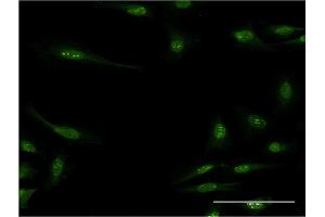 Immunofluorescence of monoclonal antibody to RBM15 on HeLa cell. (RBM15 抗体  (AA 701-810))