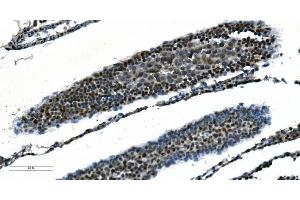 IHC analysis of CDC45L using anti-CDC45L antibody (ABIN7600230).