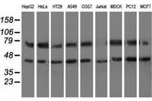 Western blot analysis of extracts (35 µg) from 9 different cell lines by using anti-HSPA6 monoclonal antibody. (HSPA6 抗体)