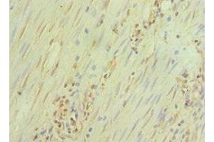Immunohistochemistry of paraffin-embedded human epityphlon tissue using ABIN7172390 at dilution of 1:100 (GATA3 抗体  (AA 1-260))