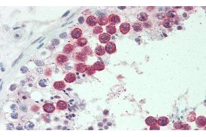 Detection of HMMR in Human Testis Tissue using Polyclonal Antibody to Hyaluronan Mediated Motility Receptor (HMMR) (HMMR 抗体  (AA 577-724))