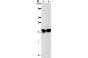 Gel: 12 % SDS-PAGE, Lysate: 40 μg, Lane 1-2: Hela cells, mouse kidney tissue, Primary antibody: ABIN7189696(ADPRHL2 Antibody) at dilution 1/500, Secondary antibody: Goat anti rabbit IgG at 1/8000 dilution, Exposure time: 2 minutes (ADPRHL2 抗体)