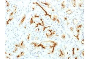 Formalin-fixed, paraffin-embedded human Pancreas stained with CFTR Rabbit Recombinant Monoclonal Antibody (CFTR/1775R). (Recombinant CFTR 抗体  (AA 258-385))