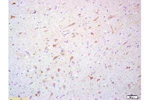 Formalin-fixed and paraffin embedded rat brain labeled with Rabbit Anti- Scavenger receptor class B member 1 Polyclonal Antibody, Unconjugated (ABIN738936) at 1:200 followed by conjugation to the secondary antibody and DAB staining (SCARB1 抗体  (AA 21-100))