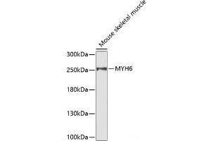 Western blot analysis of extracts of Mouse skeletal muscle using MYH6 Polyclonal Antibody. (MYH6 抗体)
