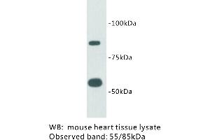Image no. 1 for anti-Transmembrane Protein 2 (TMEM2) antibody (ABIN1112936) (TMEM2 抗体)
