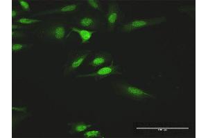 Immunofluorescence of purified MaxPab antibody to HCK on HeLa cell. (HCK 抗体  (AA 1-505))
