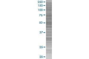 Western Blotting (WB) image for IL13RA2 293T Cell Transient Overexpression Lysate(Denatured) (ABIN1332358)