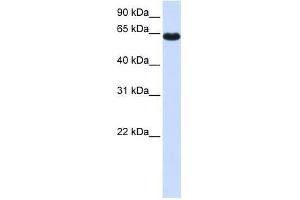 ZNF117 antibody used at 0. (Zinc Finger Protein 117 抗体  (Middle Region))