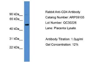 Western Blotting (WB) image for anti-CD4 (CD4) (C-Term) antibody (ABIN2787938)