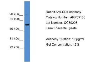 WB Suggested Anti-CD4  Antibody Titration: 0. (CD4 抗体  (C-Term))