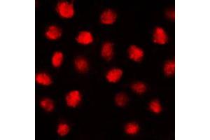 Immunofluorescent analysis of EGR1 staining in MCF7 cells. (EGR1 + EGR2 (C-Term) 抗体)