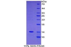 SDS-PAGE analysis of Mouse C4BPa Protein. (C4BPA 蛋白)