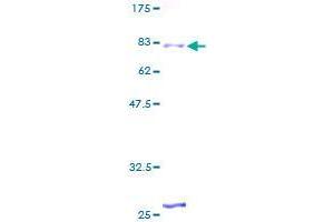 ZNF25 Protein (AA 1-420) (GST tag)