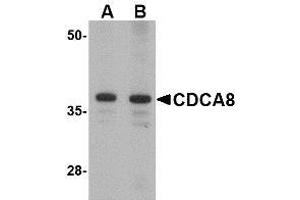 Western blot analysis of CDCA8 in Rat kidney lysate with AP30218PU-N CDCA8 antibody at (A) 1 and (B) 2 μg/ml. (CDCA8 抗体  (N-Term))