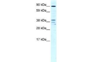 WB Suggested Anti-ZC3H7B Antibody Titration:  4ug/ml  Positive Control:  Human Liver (ZC3H7B 抗体  (N-Term))
