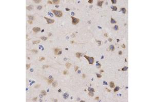 Immunohistochemistry of paraffin-embedded rat brain using KPNA4 Antibody (ABIN5971058) at dilution of 1/200 (40x lens). (KPNA4 抗体)