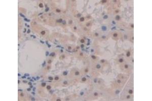 Used in DAB staining on fromalin fixed paraffin- embedded Kidney tissue (PYGO2 抗体  (AA 171-406))