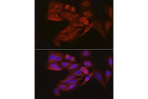 Immunofluorescence (IF) image for anti-Eukaryotic Translation Initiation Factor 4E Nuclear Import Factor 1 (EIF4ENIF1) (AA 150-250) antibody (ABIN7267051)