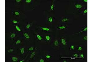 Immunofluorescence (IF) image for anti-General Transcription Factor IIIC, Polypeptide 2, beta 110kDa (GTF3C2) (AA 1-911) antibody (ABIN947948)