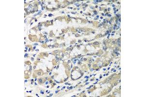 Immunohistochemistry of paraffin-embedded human stomach using CCT6A antibody at dilution of 1:100 (40x lens). (CCT6A 抗体)