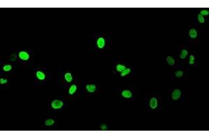 Immunofluorescent analysis of HepG2 cells (sodium butyrate, 30 mM, 4h) using ABIN7139164 at dilution of 1:100 and Alexa Fluor 488-congugated AffiniPure Goat Anti-Rabbit IgG(H+L) (Histone H1.5 抗体  (acLys16))