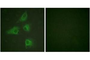 Immunofluorescence analysis of HeLa cells, using DRP-2 (Ab-514) Antibody. (DRP2 抗体  (AA 480-529))