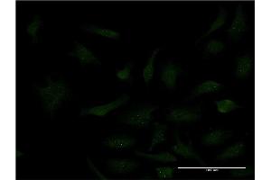 Immunofluorescence of monoclonal antibody to SP3 on HeLa cell. (Sp3 抗体  (AA 287-430))