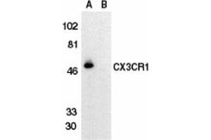 Image no. 2 for anti-Chemokine (C-X3-C Motif) Receptor 1 (CX3CR1) antibody (ABIN203578) (CX3CR1 抗体)