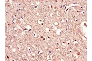 Immunohistochemistry of paraffin-embedded human brain tissue using ABIN7167318 at dilution of 1:100 (RAB39B 抗体  (AA 1-213))