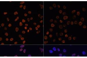Immunofluorescence analysis of HeLa cells using Acetyl-Histone H2A-K5 Polyclonal Antibody at dilution of 1:100. (Histone H2A 抗体  (acLys5))