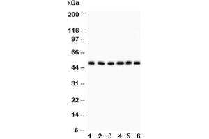 Western blot testing of GFAP antibody and Lane 1:  rat brain;  2: mouse brain;  3: U87;  4: SHG-44 (human glioma line);  5: NEURO;  6: HeLa lysate (GFAP 抗体  (AA 93-432))