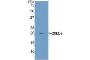 Detection of Recombinant PIN1, Human using Polyclonal Antibody to Peptidyl Prolyl Cis/Trans Isomerase NIMA Interacting Protein 1 (PIN1) (PIN1 抗体  (AA 2-163))