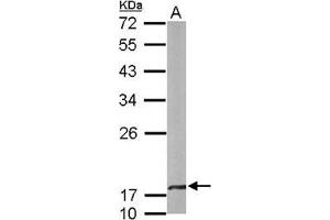 Figure 3. (CRYbA4 抗体  (N-Term))