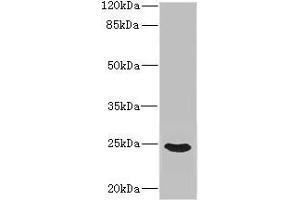 Western blot All lanes: FGF19 antibody IgG at 3. (FGF19 抗体  (AA 25-216))