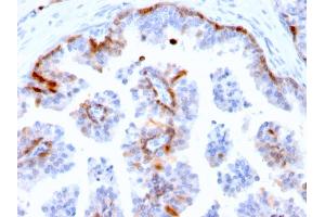 Formalin-fixed, paraffin-embedded human Prostate stained with Cystatin A Mouse Monoclonal Antibody (CSTA/2882). (CSTA 抗体  (AA 1-98))