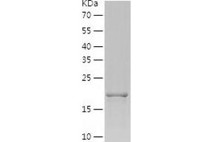 AMELX Protein (AA 17-191) (His tag)