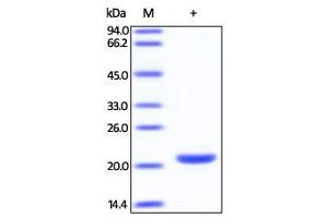 Human SMAC, His Tag on SDS-PAGE under reducing (R) condition. (DIABLO Protein (AA 56-239) (His tag))