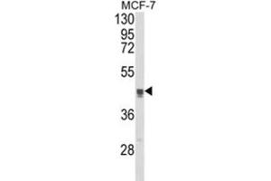Western Blotting (WB) image for anti-Trans-Golgi Network Protein 2 (TGOLN2) antibody (ABIN3003981) (TGOLN2 抗体)