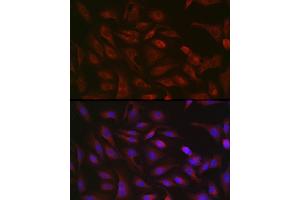 Immunofluorescence (IF) image for anti-Gasdermin D (GSDMD) (AA 276-484) antibody (ABIN7267350)