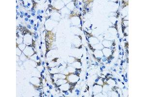 Immunohistochemistry of paraffin-embedded Human stomach using VIL1 Polyclonal Antibody at dilution of 1:100 (40x lens). (Villin 1 抗体)