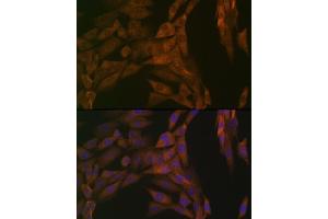 Immunofluorescence analysis of NIH-3T3 cells using PP2A alpha + beta Rabbit mAb (ABIN7269686) at dilution of 1:100 (40x lens).