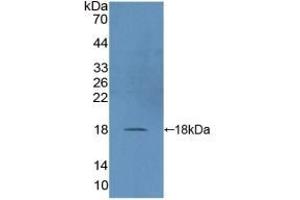 Detection of Recombinant DUSP5, Human using Polyclonal Antibody to Dual Specificity Phosphatase 5 (DUSP5)