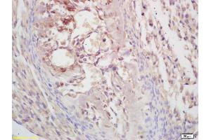 Formalin-fixed and paraffin embedded mouse embryo labeled with Rabbit Anti KLF5/UKHC Polyclonal Antibody, Unconjugated (ABIN739515) at 1:200 followed by conjugation to the secondary antibody and DAB staining (KLF5 抗体  (AA 61-160))